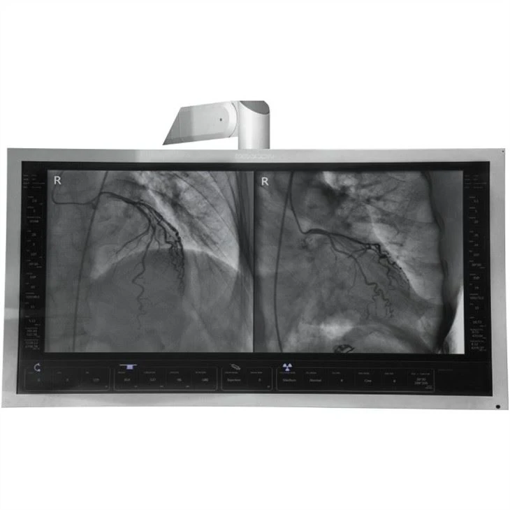 Made-in-China Hybrid Cath Lab